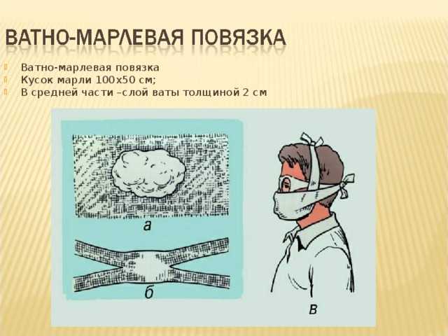 Ватно-марлевая повязка своими руками: создание, материалы, стандарты